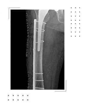Slider image (9) Dr. Rodrigo Aguirre Rojas Orthopedic Surgeon in Mexico